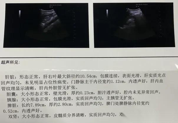 上周门诊，一位30多岁的小伙子拿着彩超报告冲进来，脸色发白：“宋院长，报告上写着