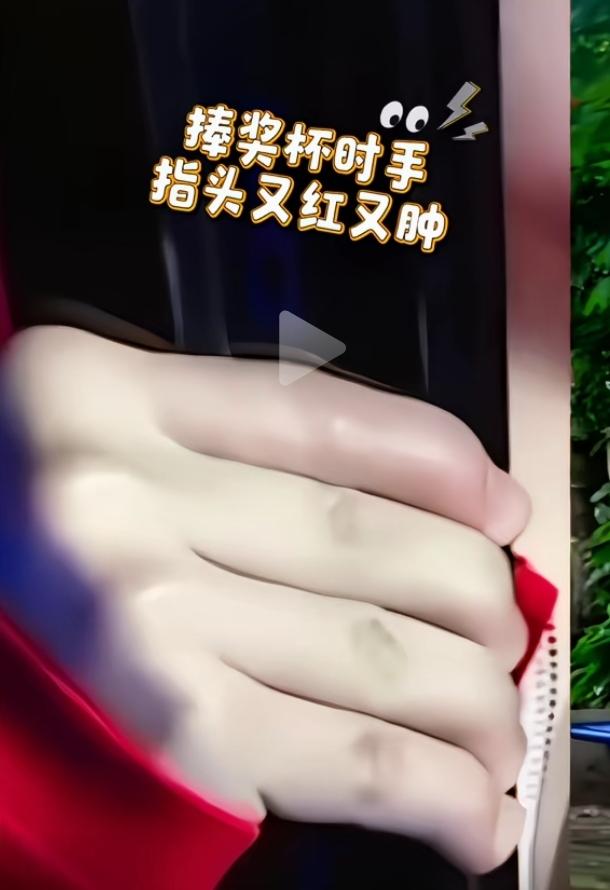 莎莎这次比赛真的看得让人心疼死了！颁奖镜头拉近才看清，她握球拍的食指红肿发亮，鼓