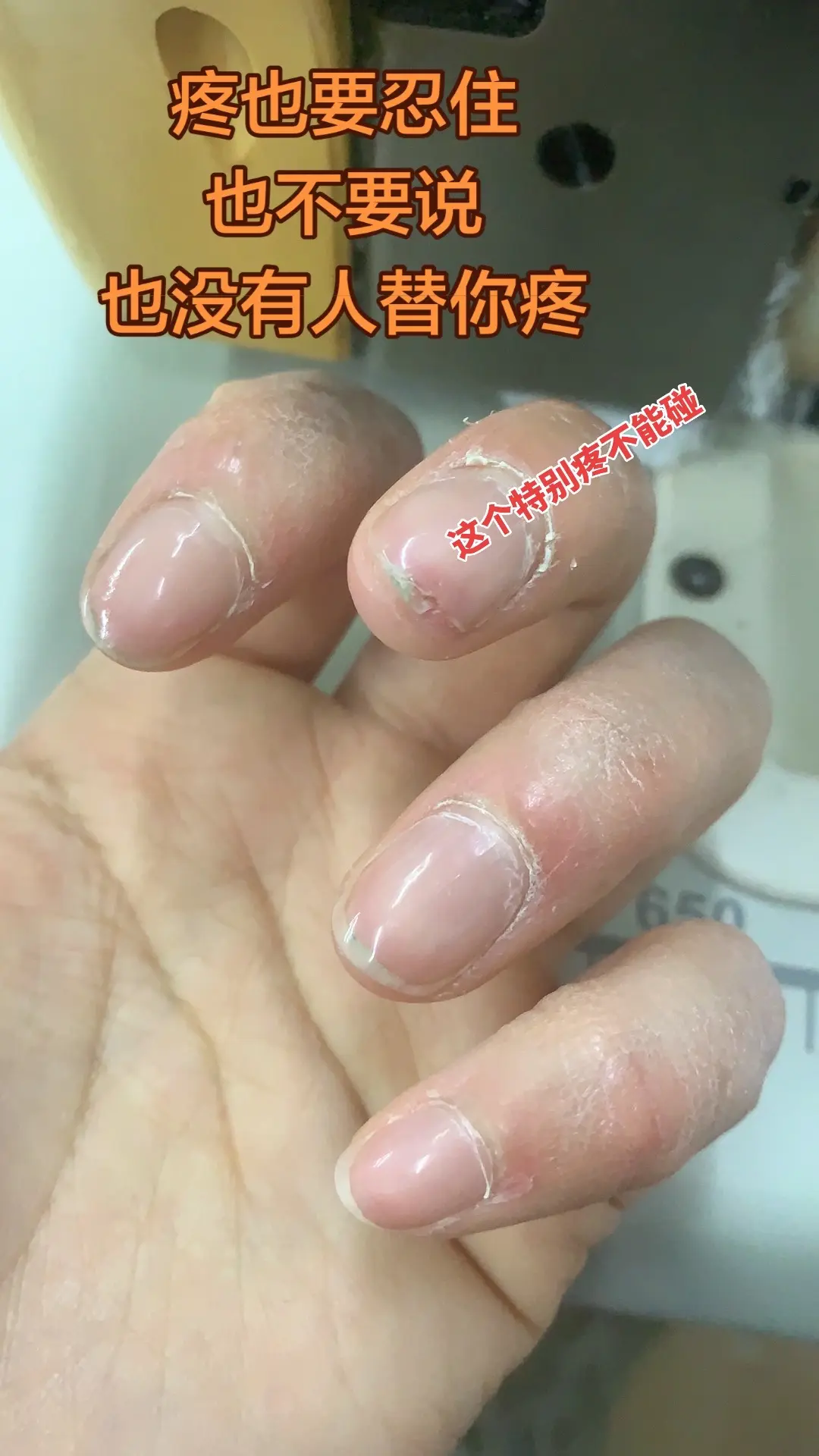 服装干了20多年，想想都疼，全是都疼