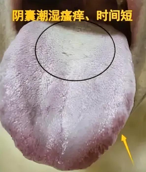 遇到这种虚不受补的舌象，吃再多的补药都没用

患者经常觉得腹痛反酸，精神差，没有