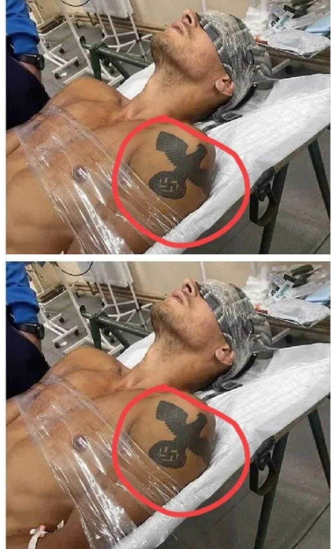 波兰社交媒体彻底炸了！
一张乌军重伤士兵送医的照片，
让波兰民众怒到破防，满屏都