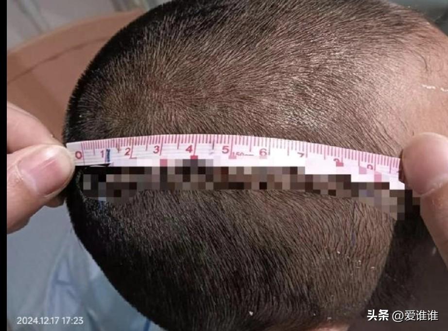 “冲动的祸！”上海，一年级学生课间嬉戏打闹，一女童受伤，女童56岁的爷爷误认为是