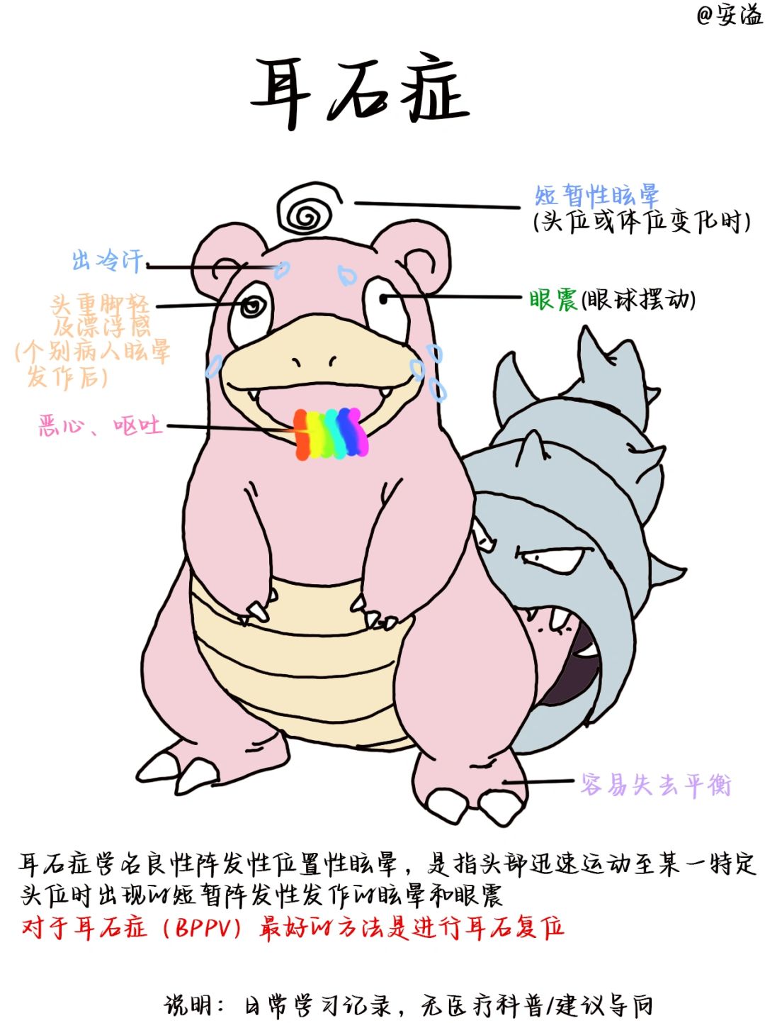 医学生绘本笔记‖耳石症