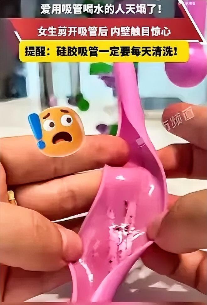 别再只冲洗外表！一根硅胶吸管，让浙江女子持续反复腹泻
 
浙江一位女生长期莫名腹
