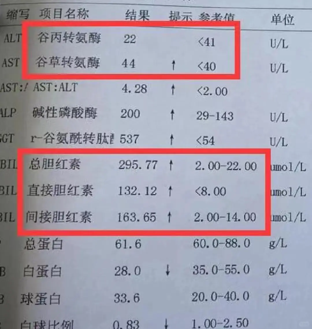 化验单中转氨酶和胆红素同时升高是什么情况
