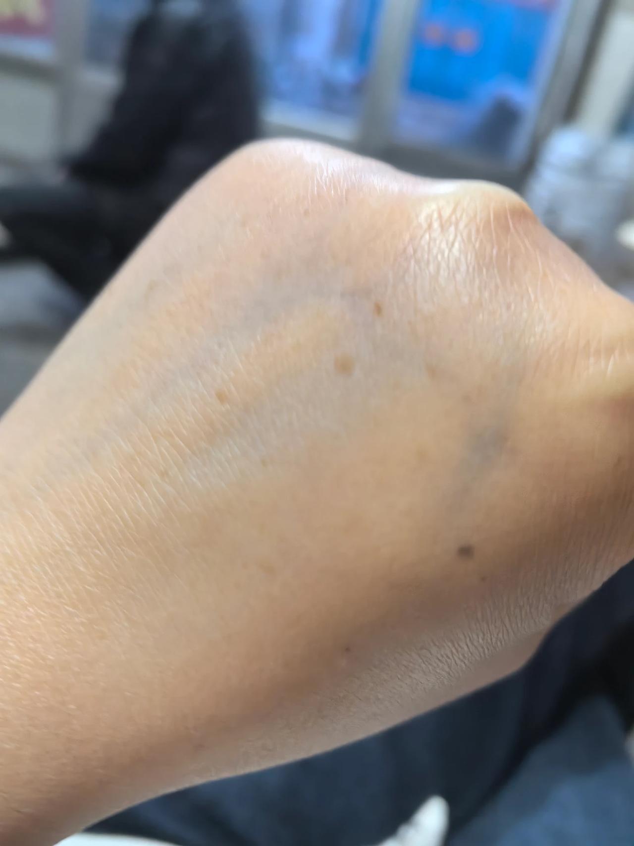 刚刚过了不惑之年，40多手上就开始有老年斑了
今天忽然发现，手上有一个个斑点，四