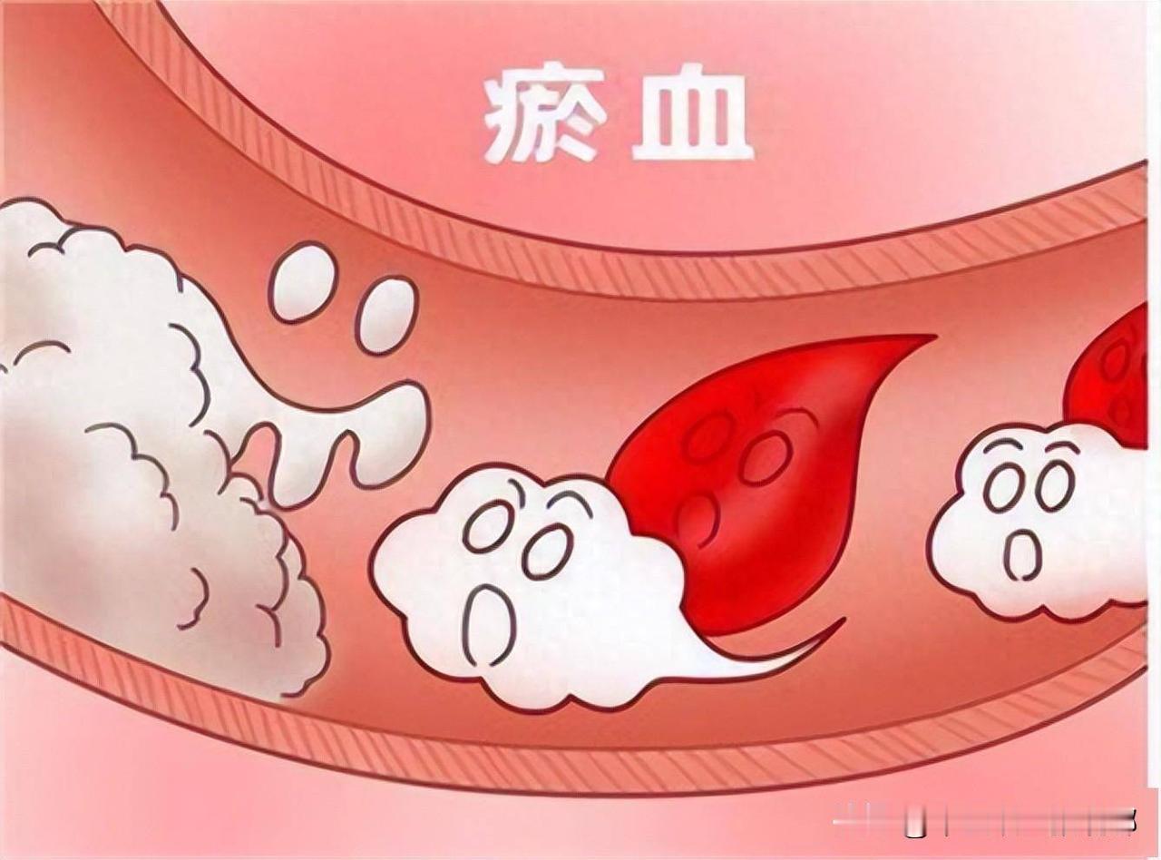 再难缠的瘀血，学会“3板斧”轻松铲除瘀血！

瘀血对很多中老年人而言，虽然小小一