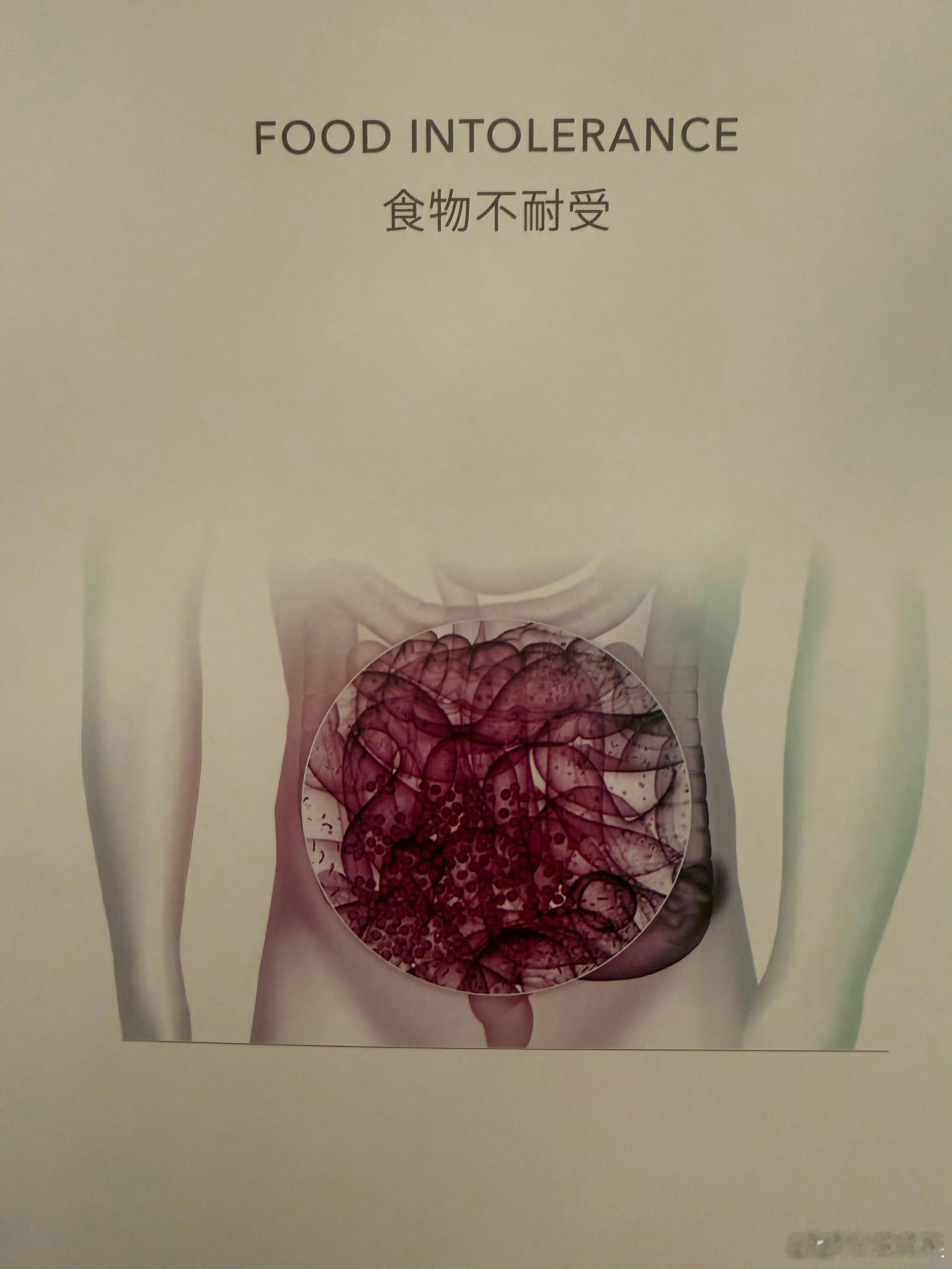 毛晓彤问查出面粉不耐受可怎么办毛晓彤回应去医美诊所 毛晓彤回应去医美诊所，原来是