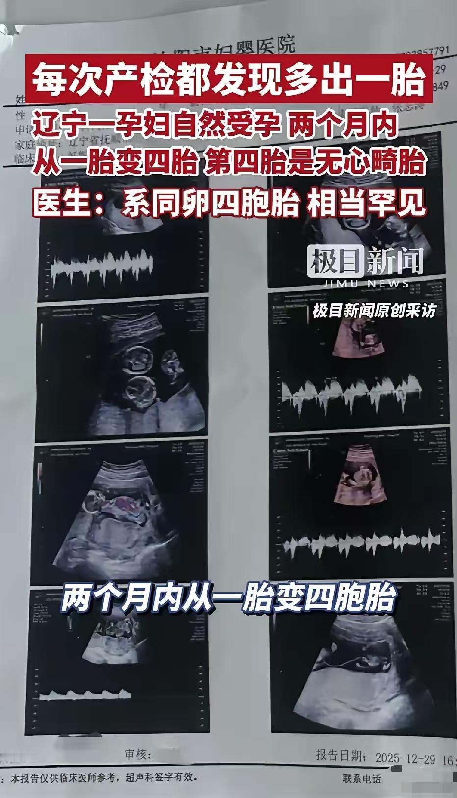 辽宁抚顺，一位30岁女子自然受孕后去医院产检，结果却发现，每一次产检胎儿都会多一