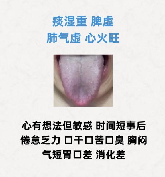 舌象辨证：3 种男性常见证型的舌象与表现