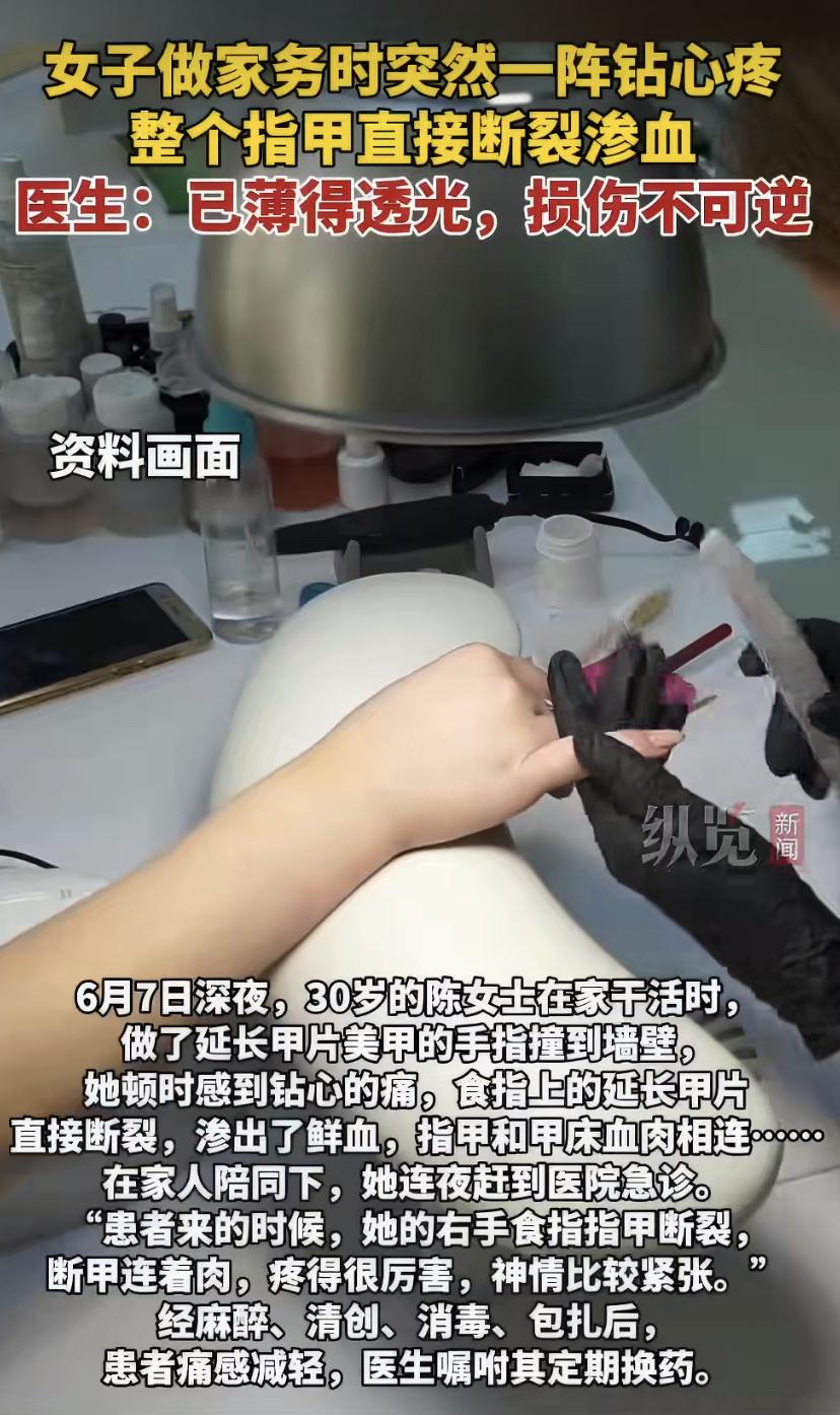 女子长期做美甲，手指撞墙指甲断裂，鲜血直流!医生重要提醒
武汉一位30岁的陈女士