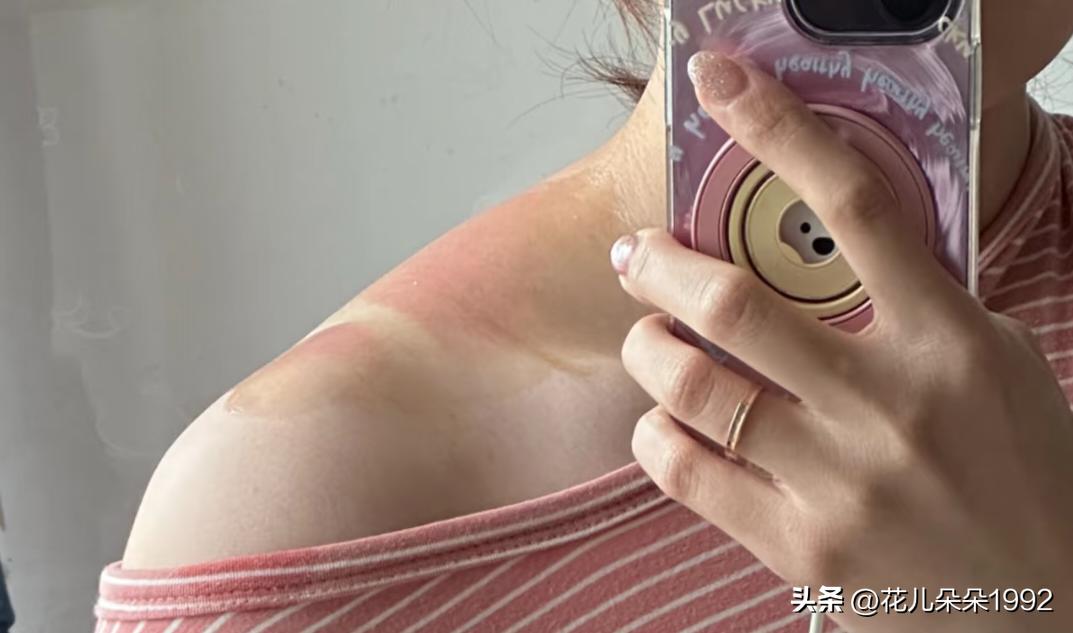 是不是云南的紫外线比贵州还厉害？？？