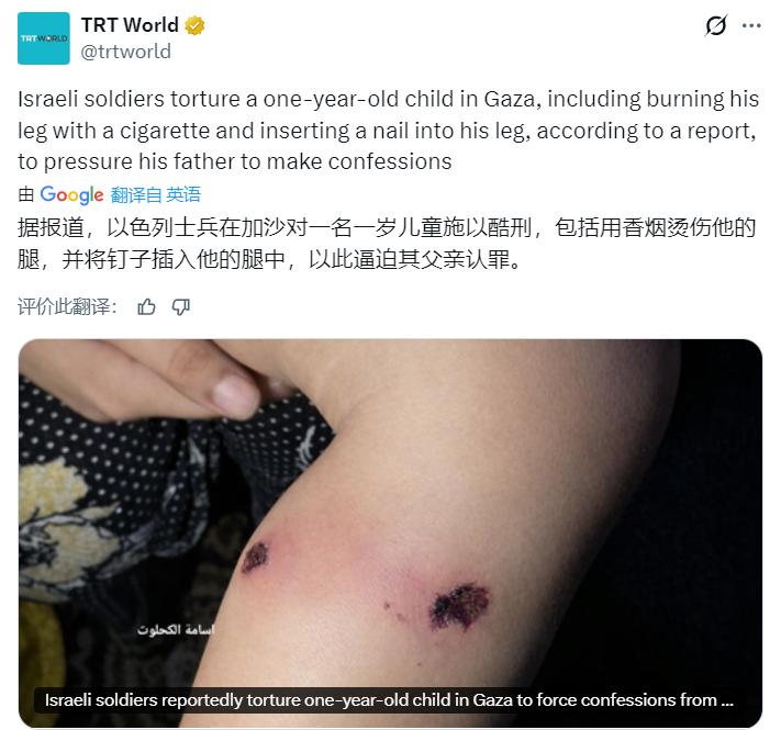 禽兽不如！[发怒]
据土耳其国家公共广播公司：以色列士兵在加沙对一名一岁儿童施以