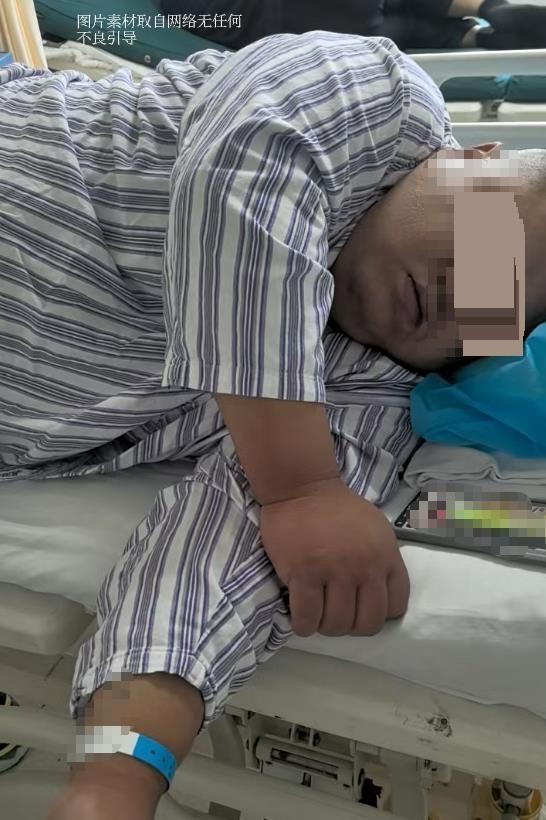 一位体重268斤的年轻男性在袖状胃切除术后第三天宣告不治。这场以追求健康为初衷的