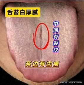 32 岁张先生，欲望非常强，偏偏房事又不给力[吃瓜群众][吃瓜群众][吃瓜群众]