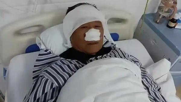70岁老人舍身救人，鼻子被行凶者咬掉吞下，他是真正的平民英雄！总有平凡人，在危难