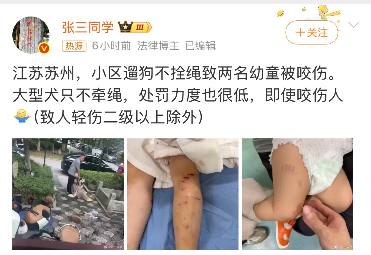 苏州遛狗不拴绳咬伤两名幼童建议小区禁止养大型犬，大型犬要是发起狂来，就算主人拉着