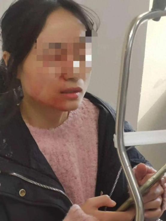 “离大谱！”浙江瑞安，42岁英语老师课间看到一男一女两名同学打架，便进行劝阻，竟