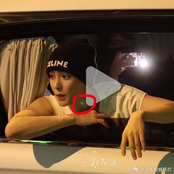 侯明昊疑似被激光笔照射律师谈侯明昊疑被激光笔照射别把激光笔当成普通玩具，大功率光