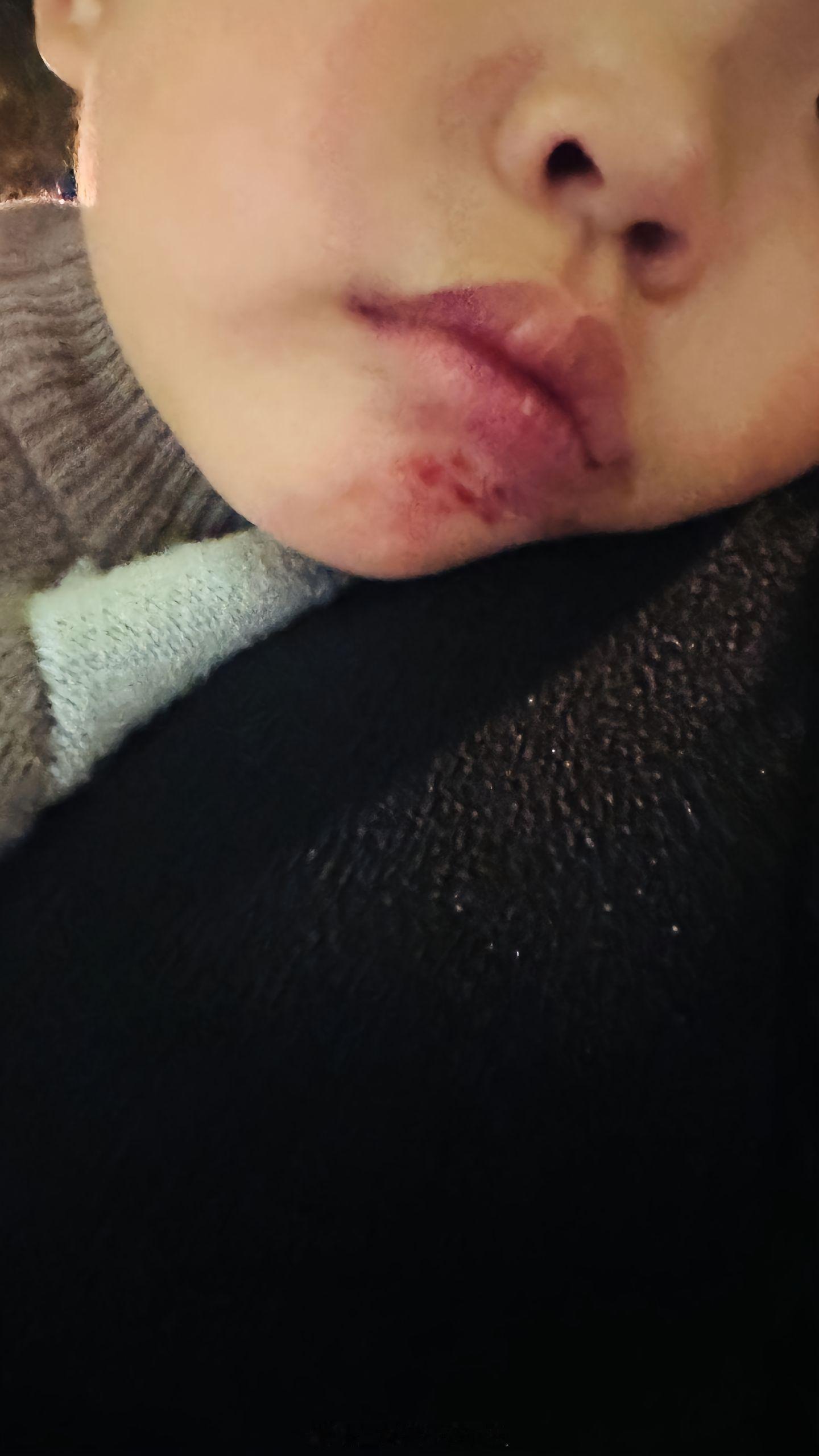 奇葩网友：骑扭扭车从坡道冲下去撞到墙，找不到投诉坡道设计缺陷的单位……[费解] 