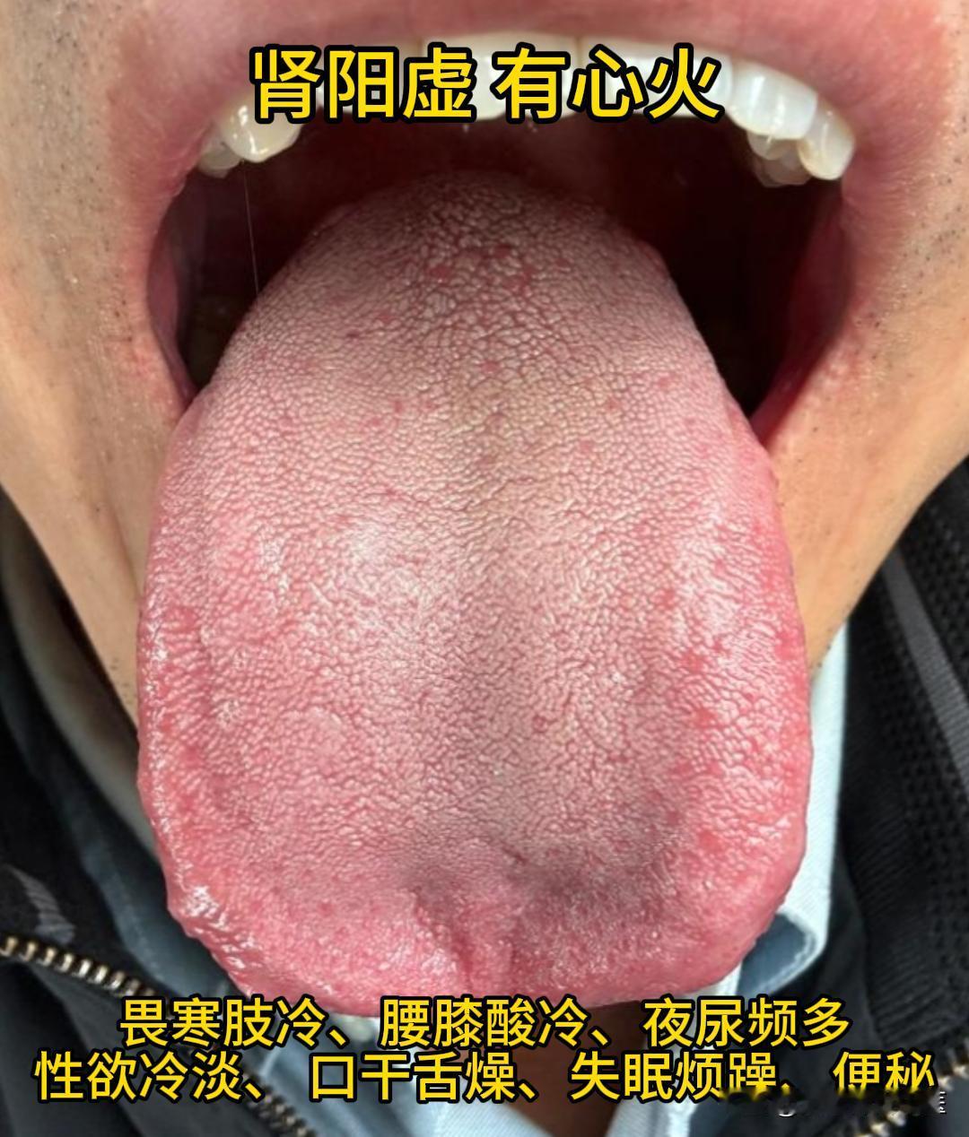 今天有空，可以帮大家看看舌象。

有需要的，尽管把你的舌象照片发过来吧！越早发，