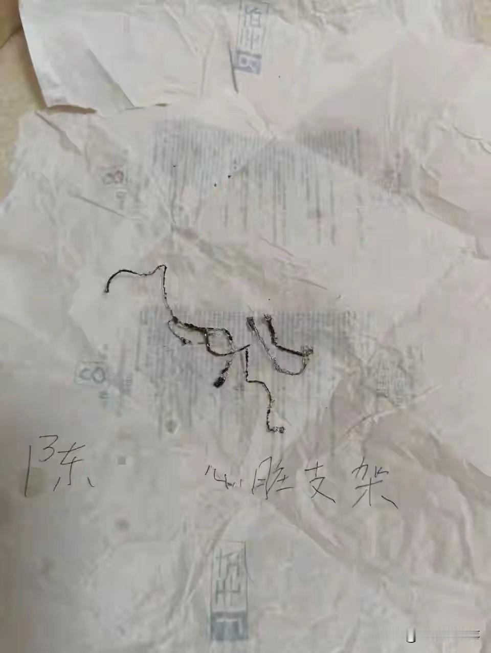 谢天谢地，10年前我就没同意装支架。如今这么多年过去，我非但没有急性心肌梗死，连