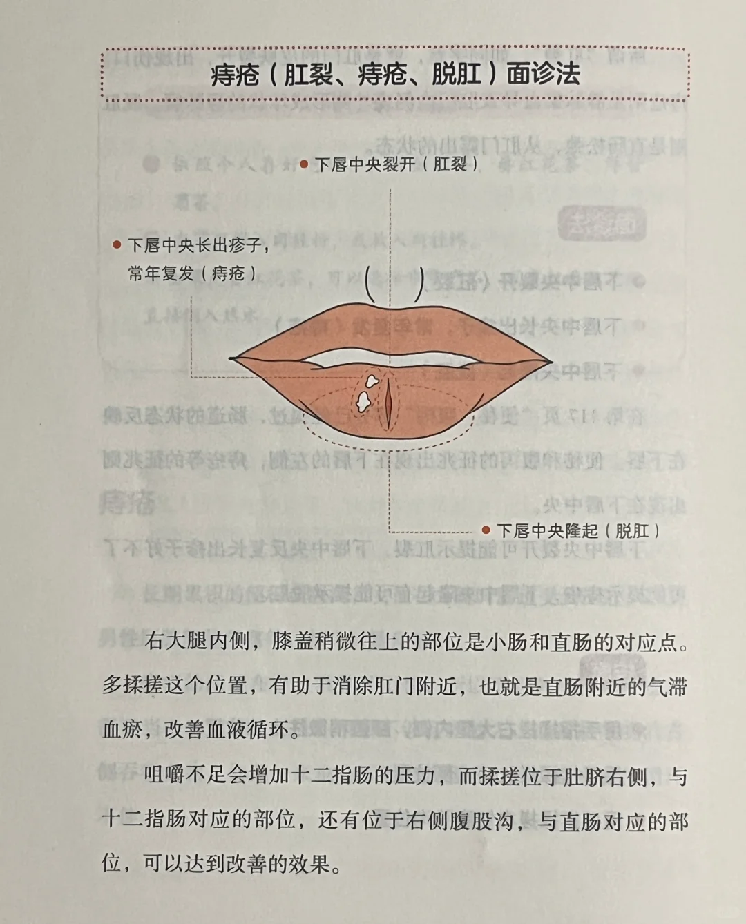 痔疮、肛裂、脱肛面诊法及自我照护