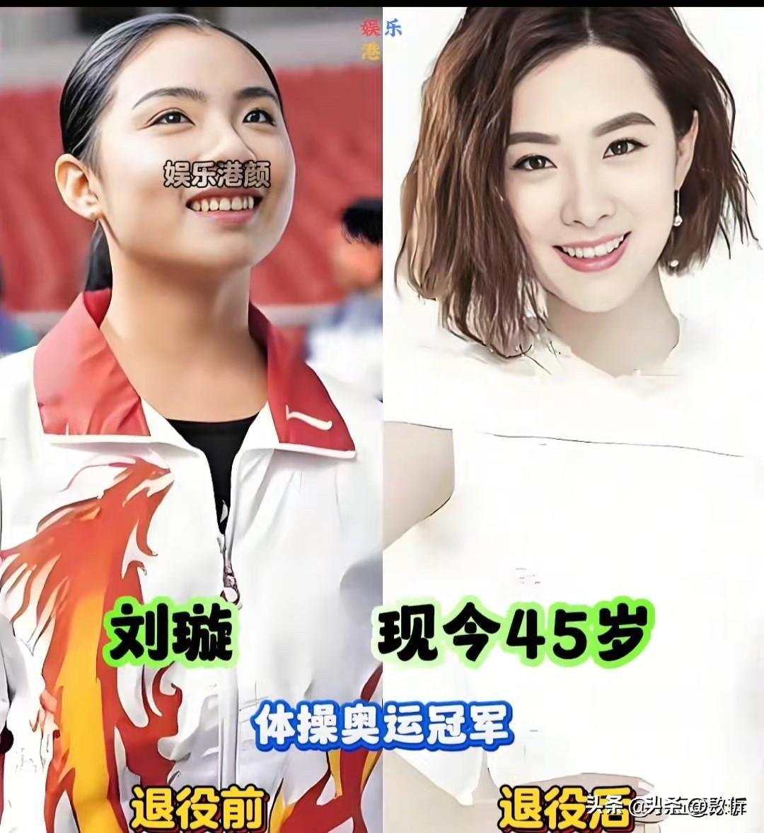 奥运冠军退役前后对比，郭晶晶嫁入豪门，有人胖到认不出来。

从赛场到人生新篇，有