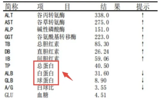 白蛋白低于这个数，腹水找上门！肝硬化速看