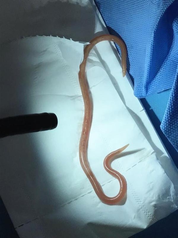 12月21日湖南祁阳市卫生健康局对“手术钻头遗留患者体内”事件发了通报。这事发生