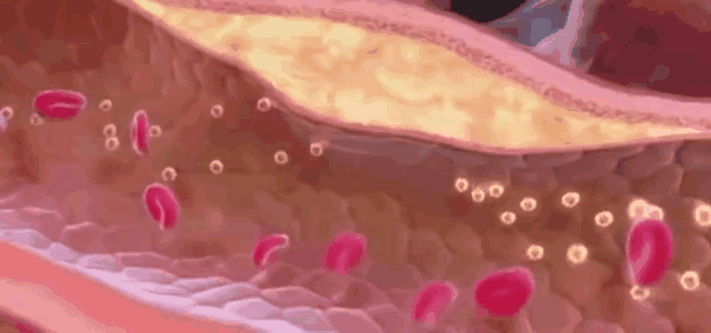 血糖太高，皮肤会“报警”：4个皮肤异常暗示血糖在升高，别忽视！1、皮肤干燥和瘙痒