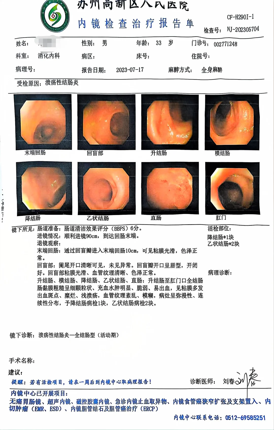 真的要警惕炎症性肠病导致的肠道肿瘤可能。