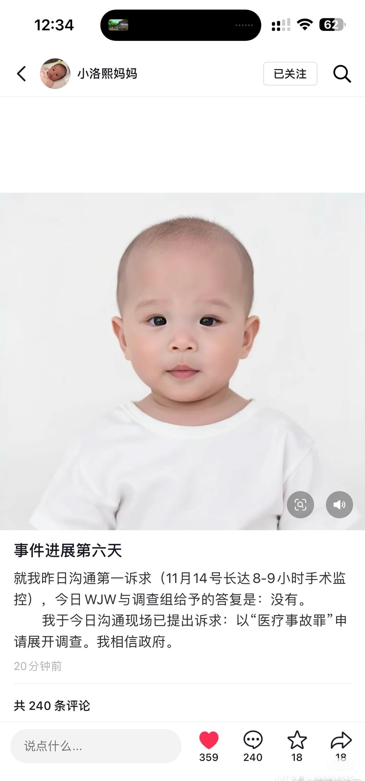都是普通人
都知道那条路有多难走[伤心][伤心]
小洛熙妈妈宁波妇幼女婴心脏手术