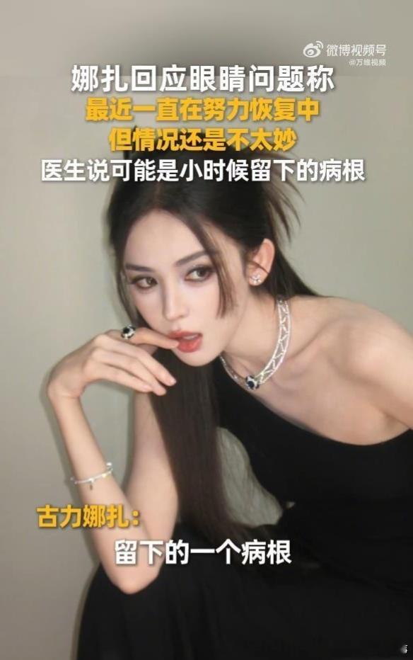 娜扎自曝：眼睛的问题困扰她好久了，医生说可能是小时候留下的病根 