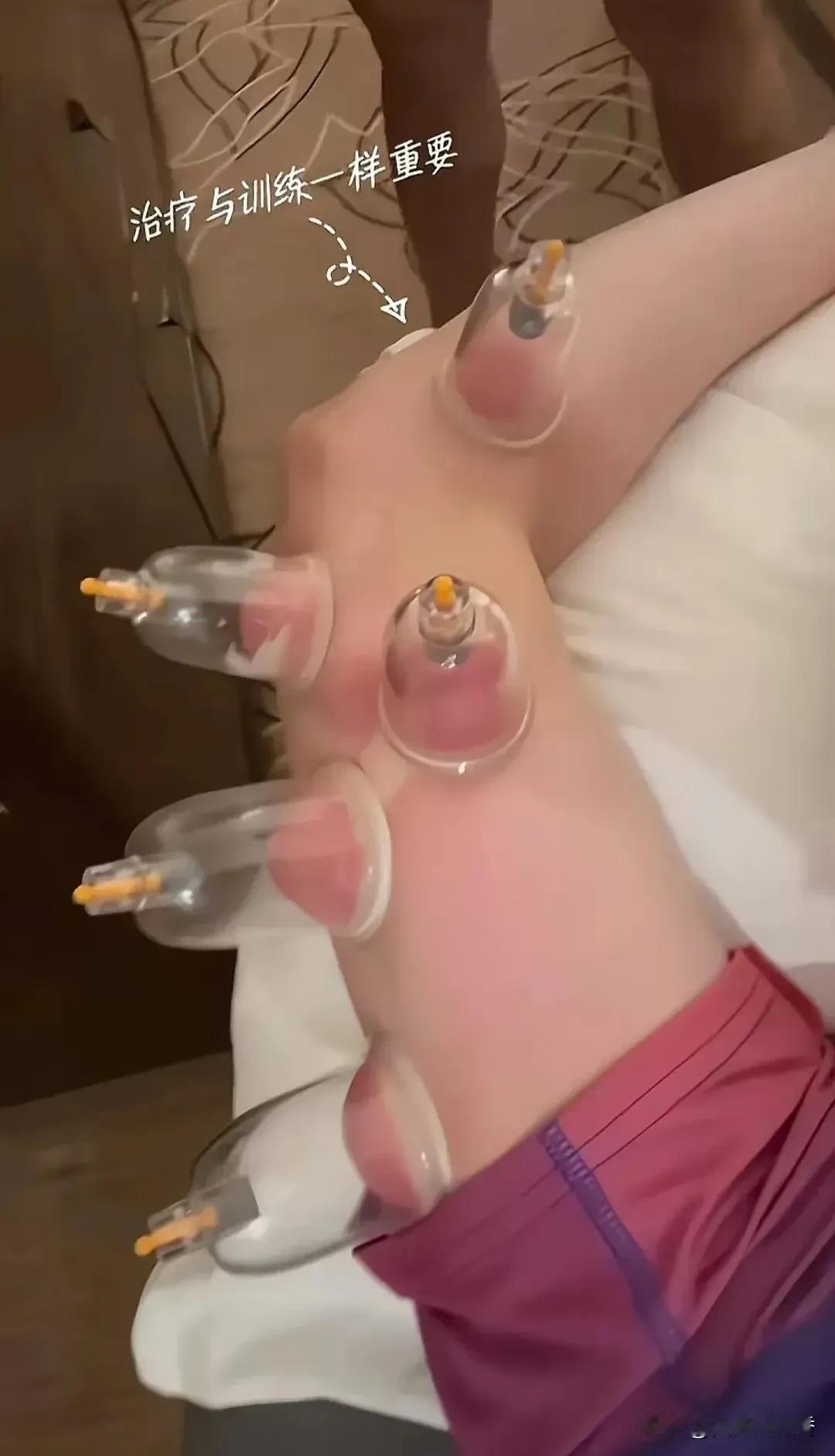 泪目，莎莎正在做治疗的画面！
一个23岁的孩子，上海交大2019级人力资源管理的