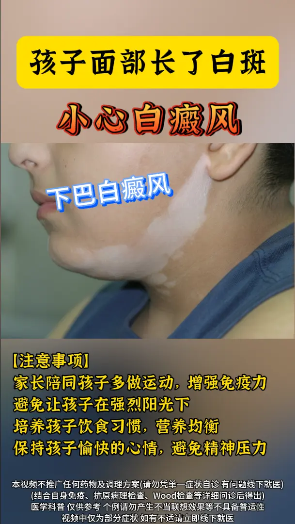 医学科普 白斑 白癜风 硬核健康科普行动  知识分享