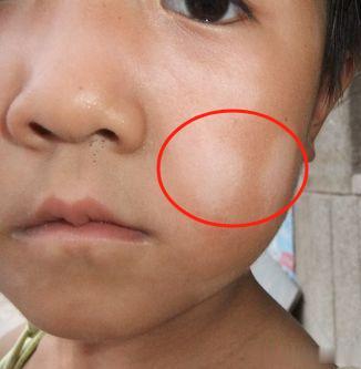 孩子有这些表现，很难长高！
 
你家孩子有没有下面这些表现？
 
1、积食厌食挑