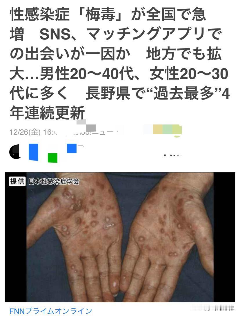 “梅毒”正在日本急速扩展，
感染范围覆盖了日本全囯。
以温泉和滑雪闻名的长野县