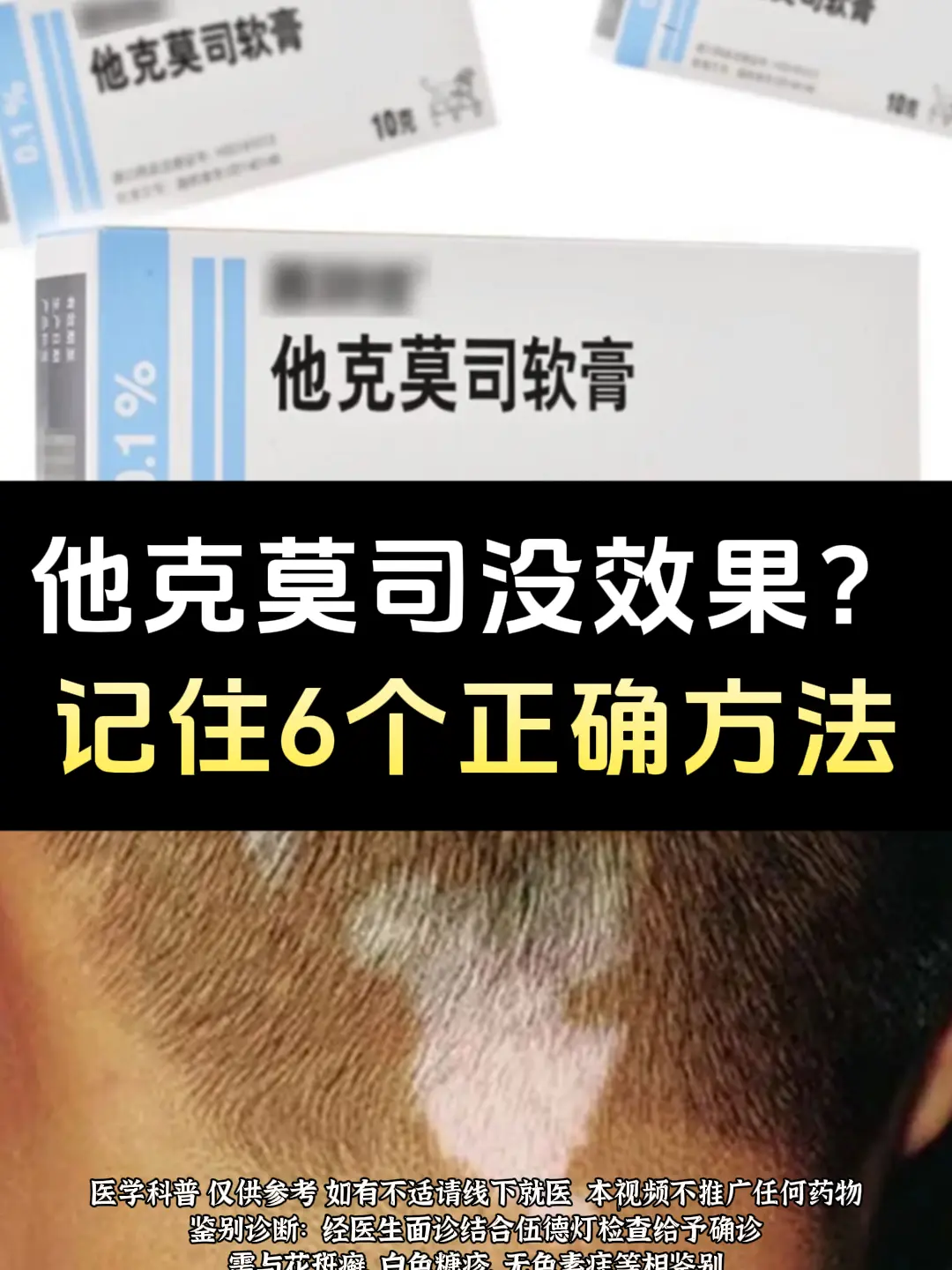 白癜风朋友注意了，他克莫司软膏不要过度涂抹，涂多了可能会引起皮肤表皮刺...