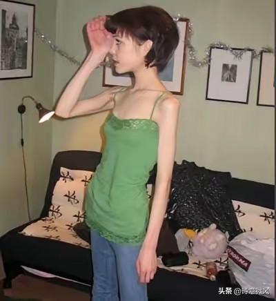 河南一90后女子为减肥辟谷，半个月不吃饭、只喝水，一个月瘦了40斤，代价是什么？