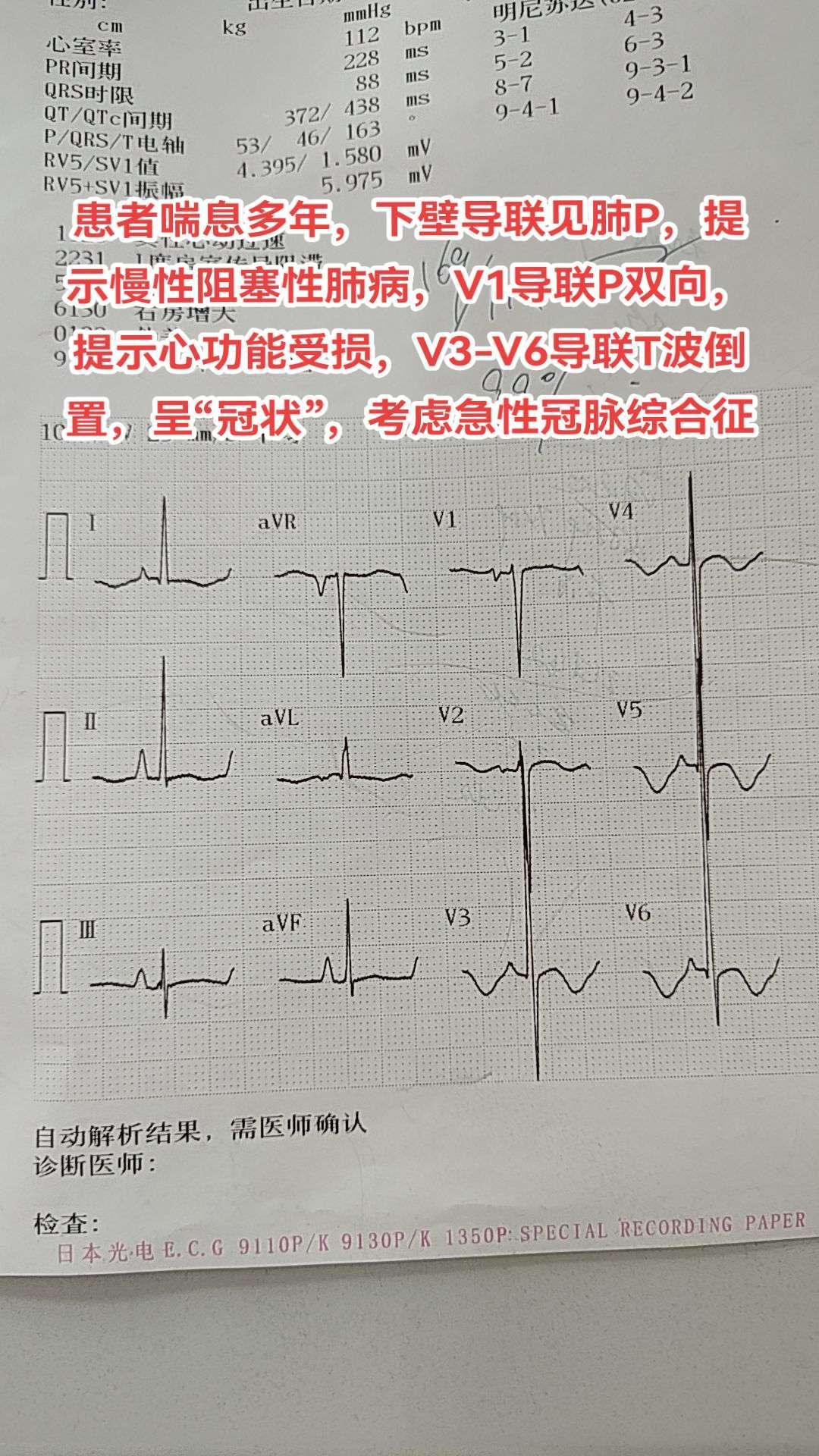 心电图。一图多解