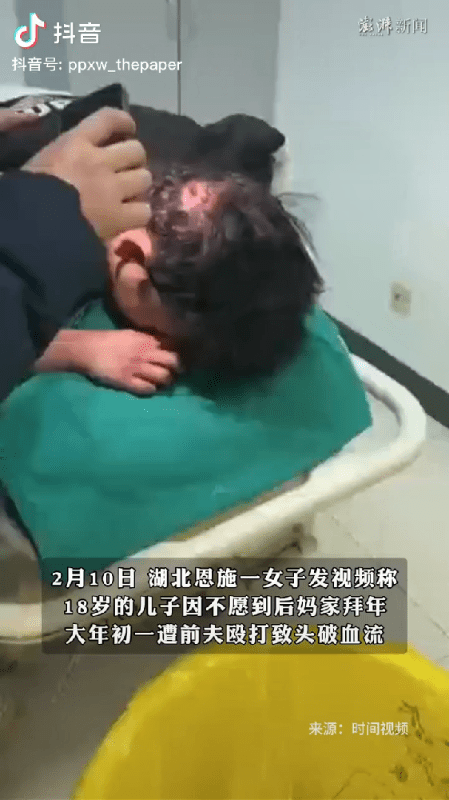 惊愕！“为了一个烂女人，把我儿子打得头破血流！忍心吗？”2月10日，湖北恩施，1
