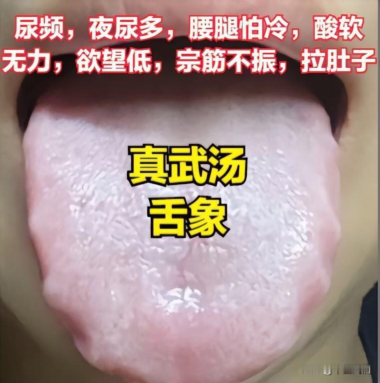 几个舌象带来的症状！推荐你用这几个方子调理....
一人一方！如果你也有这方面的