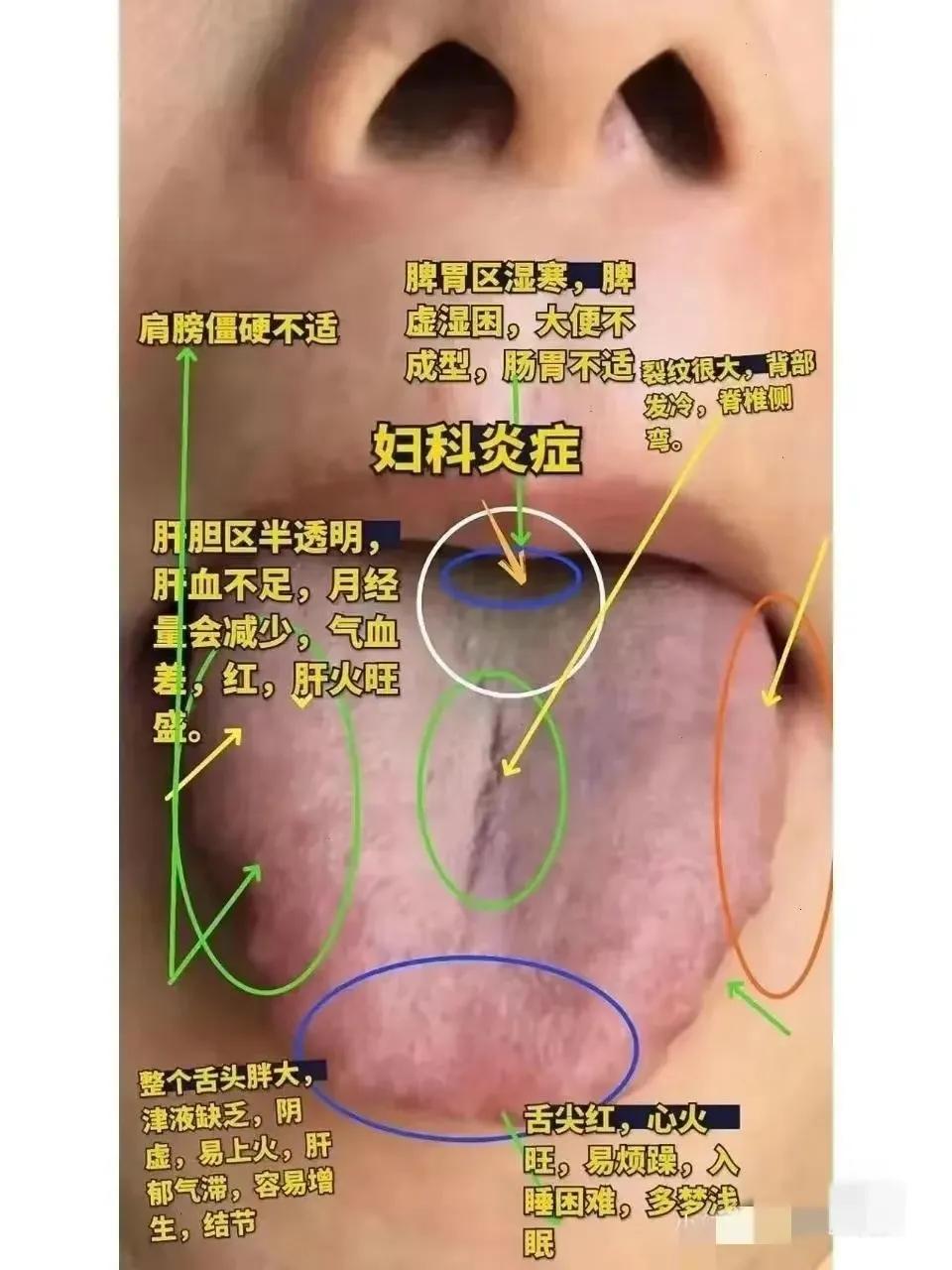 你知道中医望闻问切四诊中的舌诊吗？想要学习舌诊并不难，只需掌握几个关键点！

舌