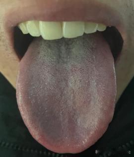 脾虚湿重，参苓白术散没用？中医：补脾不补肾，等于白费力！
今天这位粉丝的问题，因