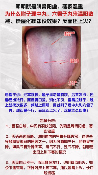 今日舌象分析