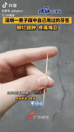 “悲剧还是发生了！”7月28日，广东一男子不小心踩在自己用过的牙签上，眼看伤口就