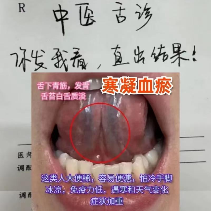 中医公益，第1天，你发我看，直出结果！
舌象尽量拍全，无美颜，无曝光！

1.寒