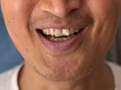 好几天没刮胡子，拍个照留个纪念，反正也不需要出门见人