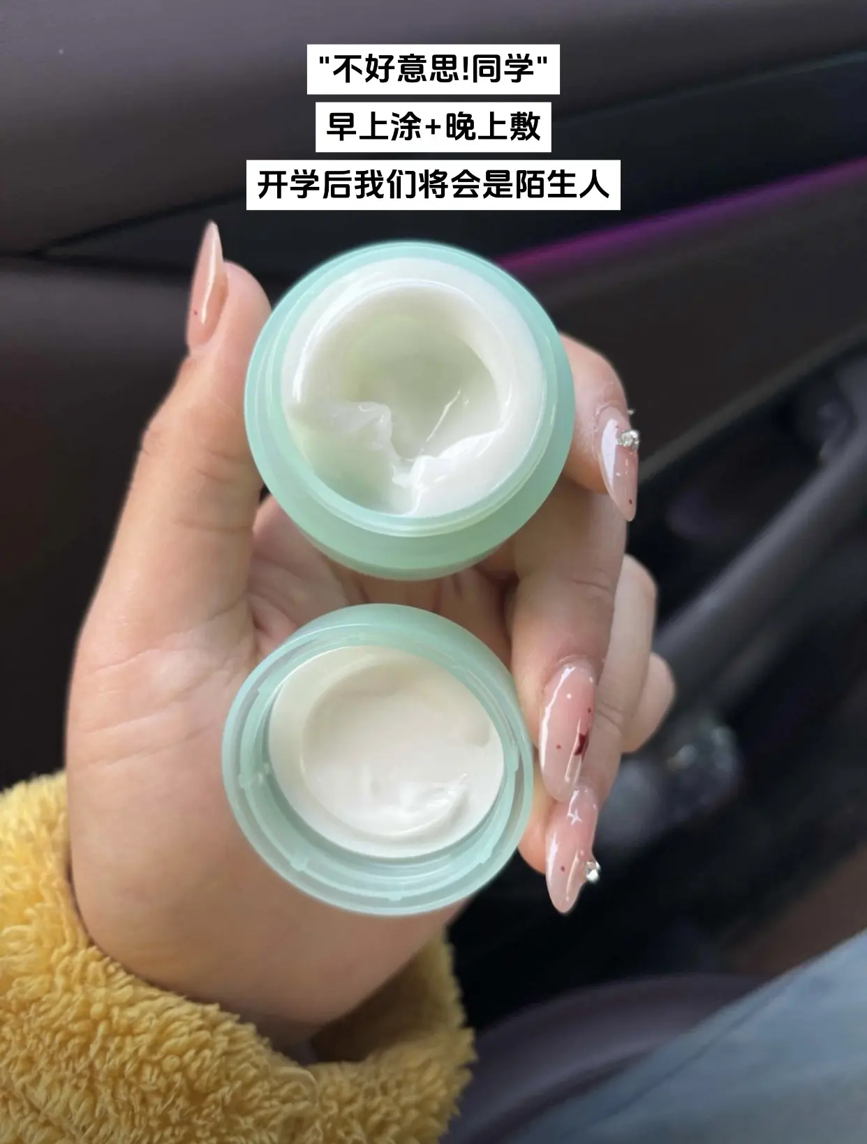 巨巨好用的袋鼠妈妈祛痘膏，真的离不开它了!